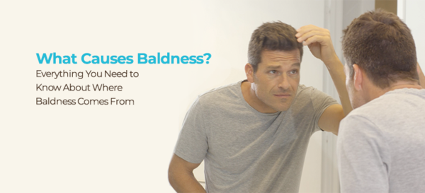 What Causes Baldness? Everything You Need to Know About Where Baldness Comes From