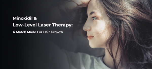 Minoxidil & Low-Level Laser Therapy: A Match Made For Hair Growth