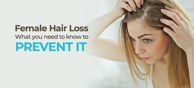 Female Hair Loss, Why It Happens and How to Treat It